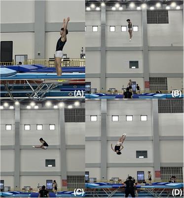 Integrative rehabilitation in the treatment of lumbosacral muscle strain in elite trampoline athletes: a pilot study
